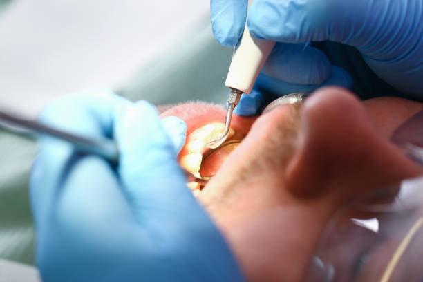 Best Root Canal Emergency Dentist  in South Floral Park, NY